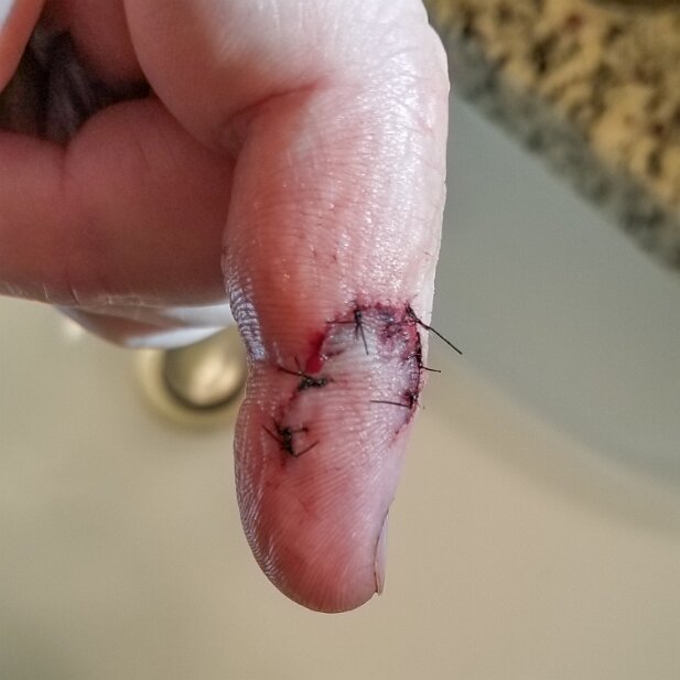 Misc 2021 Laceration